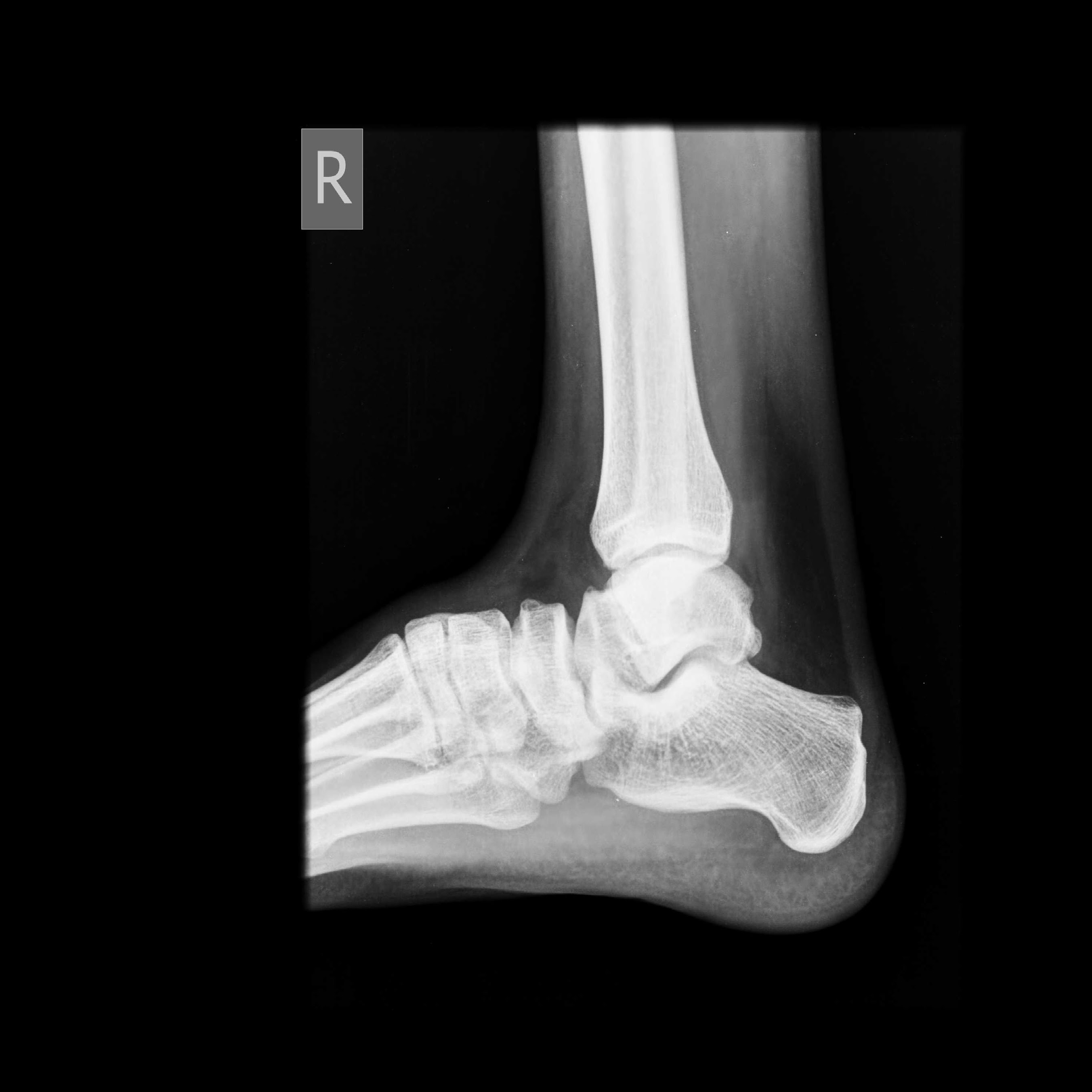 Cricket, Injuries and Bad Habits